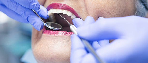 Best Emergency Dental Care for Broken or Chipped Teeth in Rtez, CO